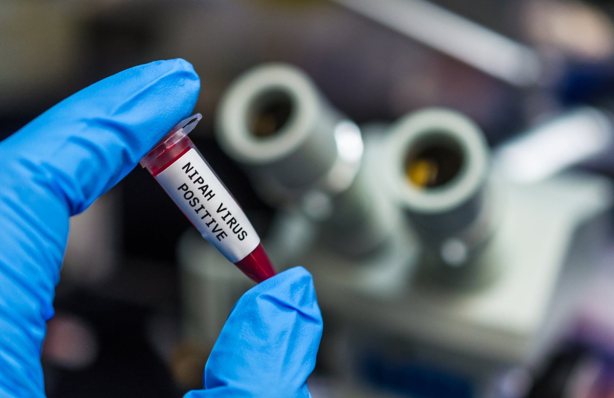 Muestra de sangre positiva para el virus Nipah