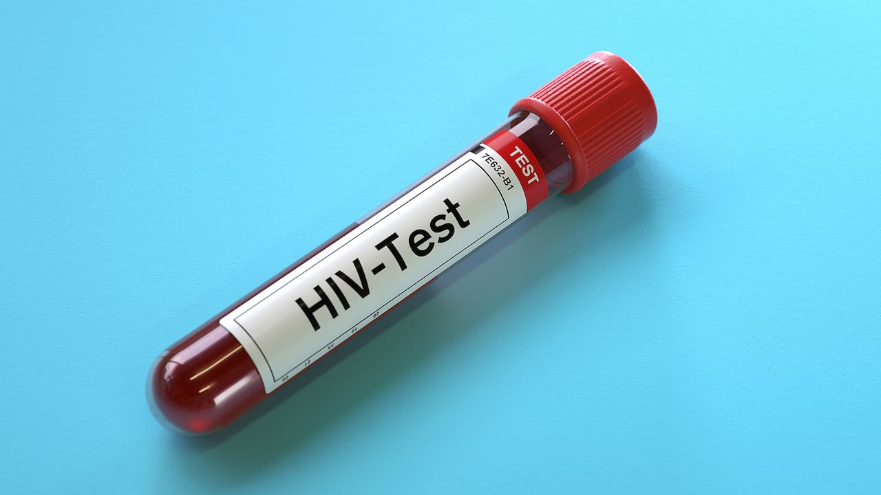 Representación de una prueba de sangre con VIH.