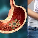 Parásitos intestinales e hinchazón abdominal.