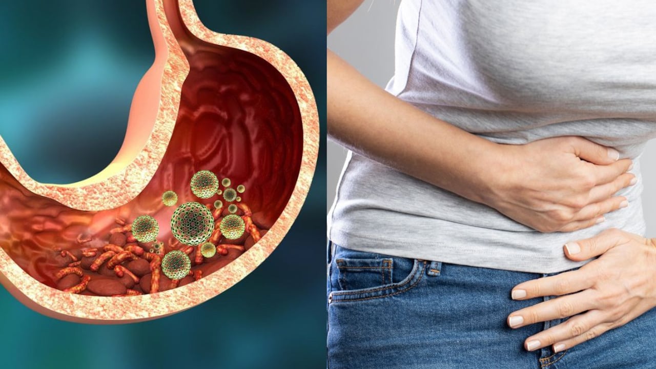 Parásitos intestinales e hinchazón abdominal.