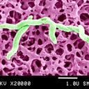Campylobacter es una familia de bacterias Gram negativas curvas. Se han identificado varias especies. Campylobacter Pylori El agente causal de gastritis, úlceras. . . , Campylobacter Fetus y Campylobacter Jejuni. Microscopía electrónica de barrido de Campylobacter Jejuni. Semi 20000X. (Foto de BSIP/UIG a través de Getty Images)