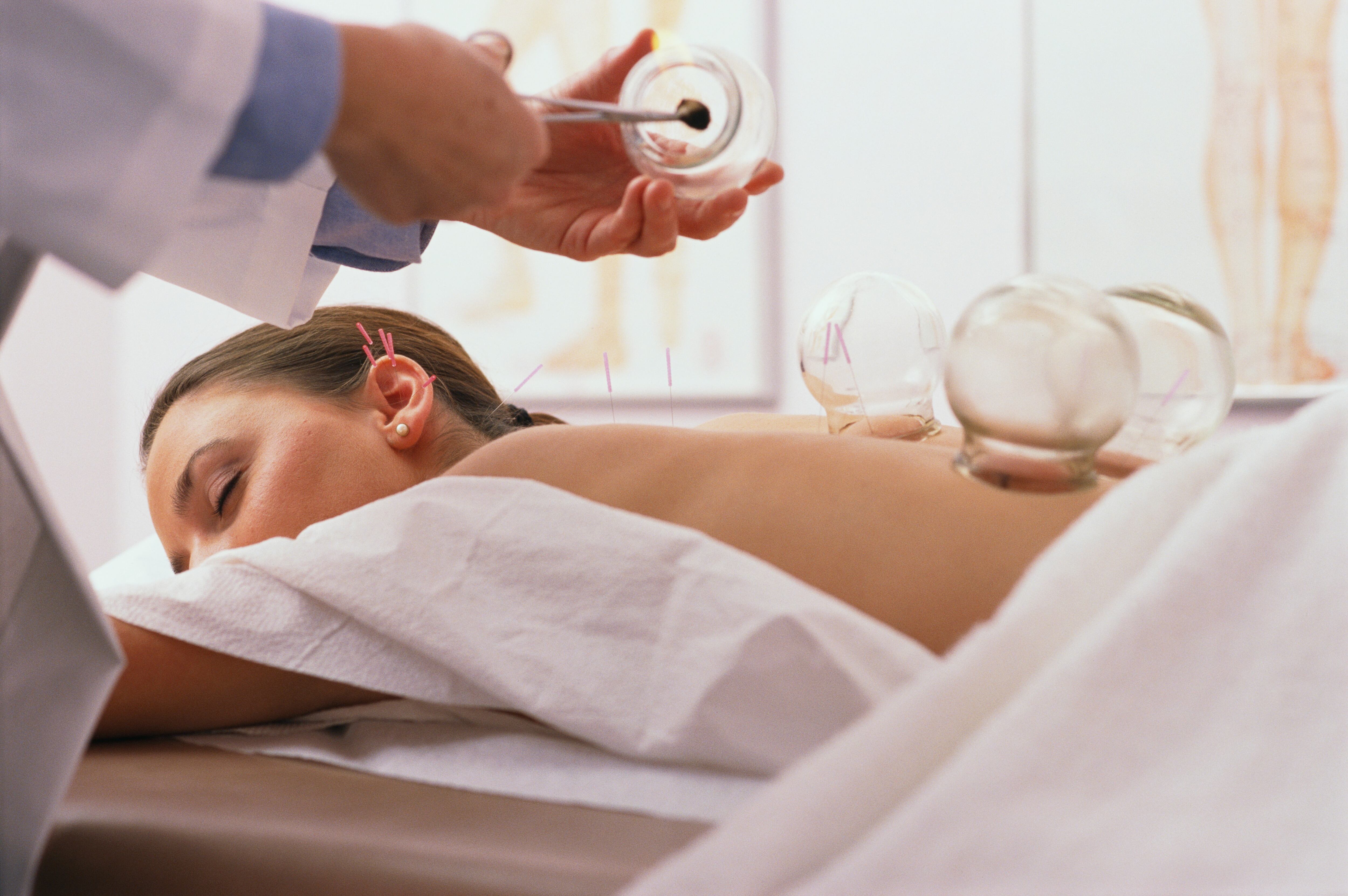 Esta técnica debe ser realizada por profesionales.