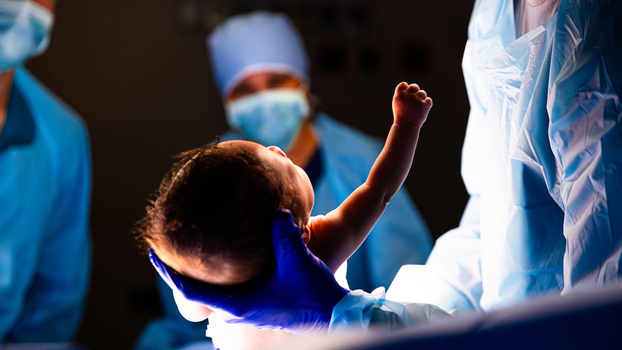 La sorprendente historia del bebé que “nació” dos veces para salvar su vida.