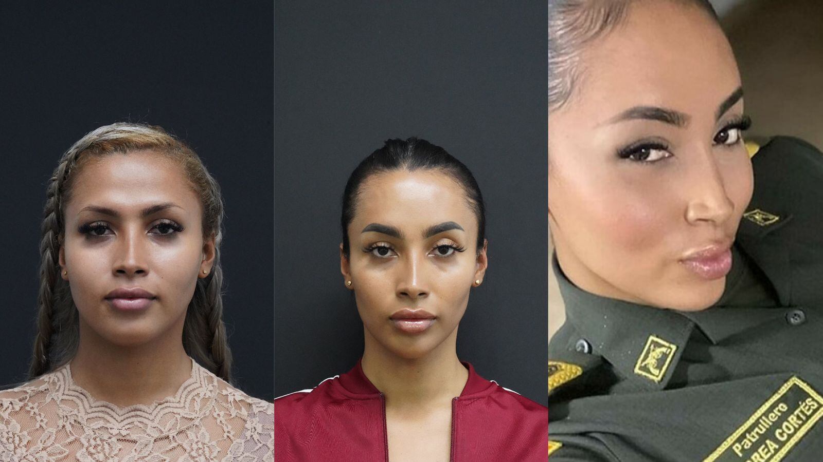 Así quedó Andrea Cortés, luego de la cirugía realizada por el doctor Ricardo Morales