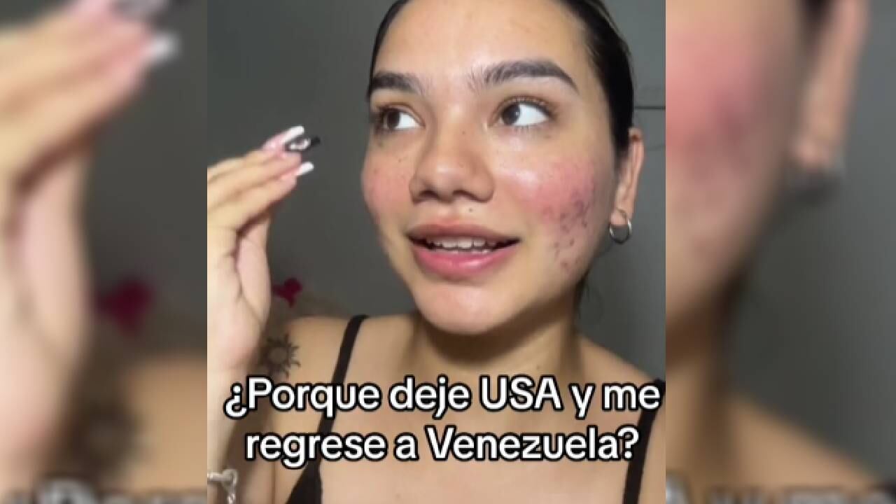 La venezolana confía en salir adelante desde su país.