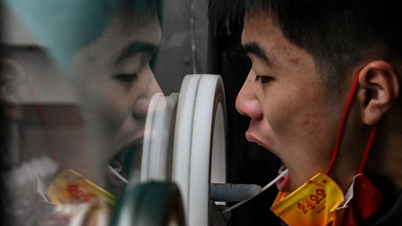 China vive un repunte de contagios luego que el país moderara las restricciones para combatir la pandemia de covid-19.