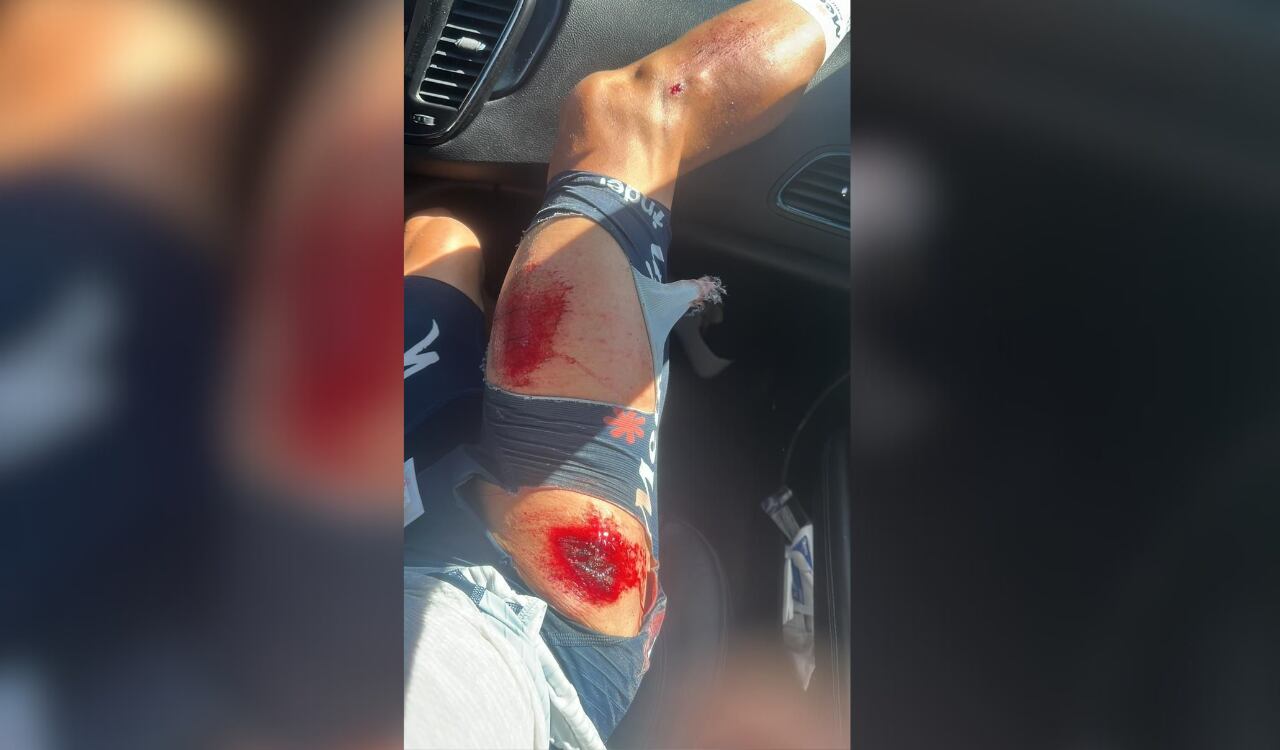 Pierna y cadera derecha, las más afectadas tras la caída de 'Supermán' López.