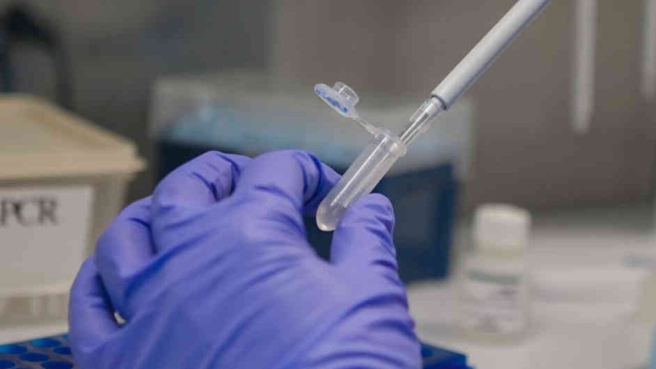 Plasma, el tratamiento para el coronavirus que se está desarrollando en Colombia