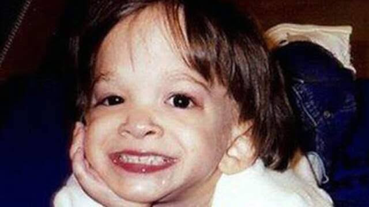Brooke Greenberg, la mujer de 20 años que parecía una bebé.