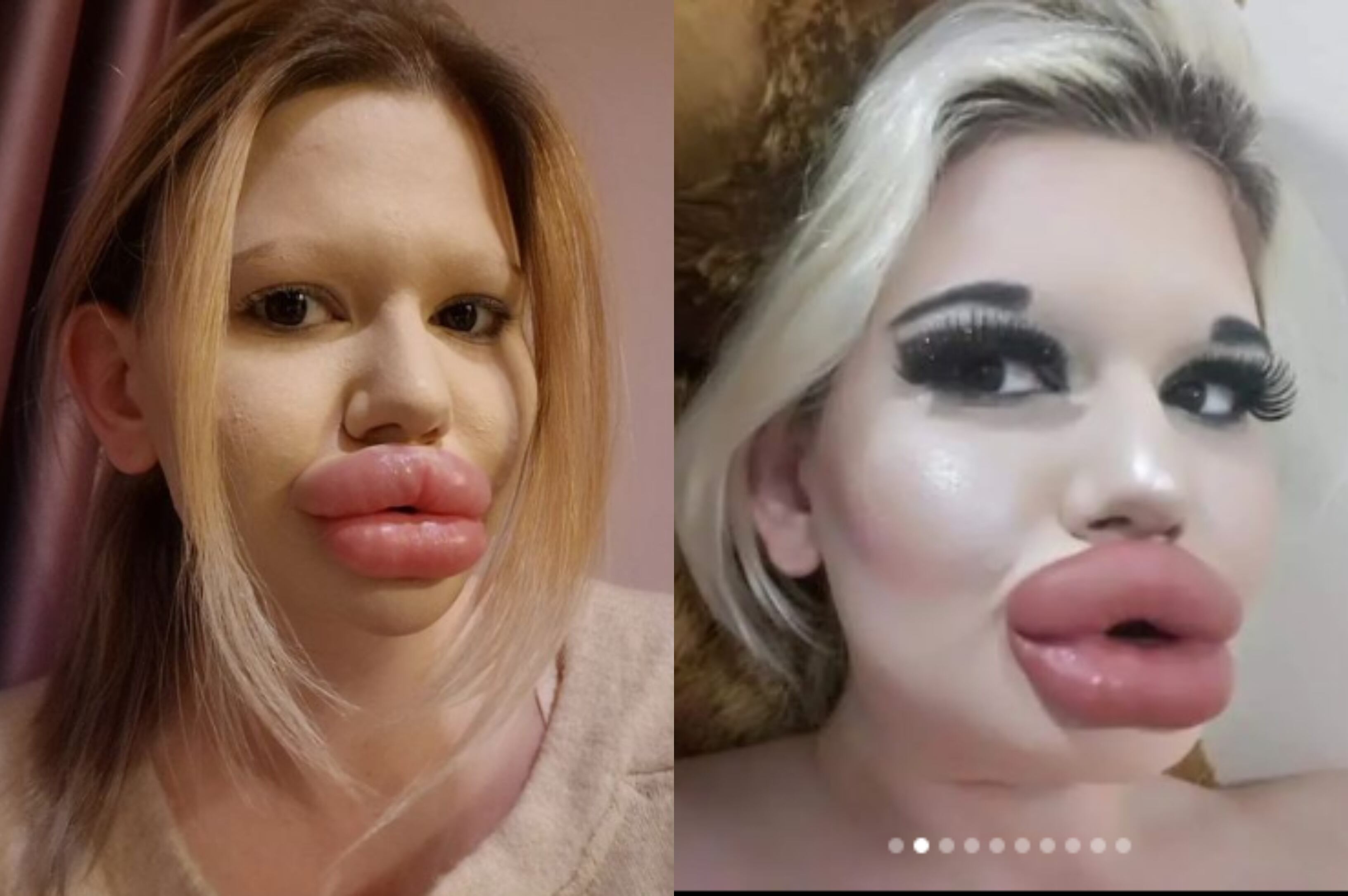 Andrea Ivanova, la mujer con los labios más grandes del mundo.