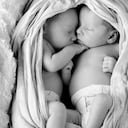 Gemelos en el Reino Unido nacen con diferente color de piel y cabello