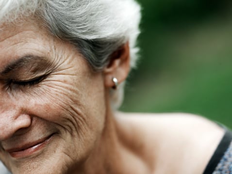 Las arrugas son parte del envejecimiento natural de la piel.