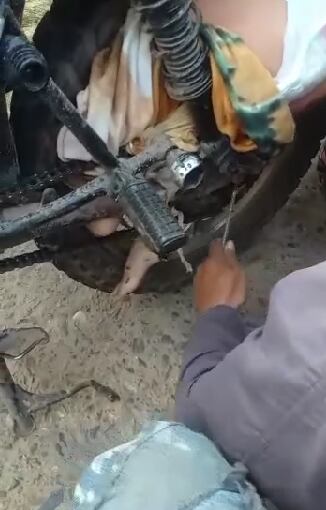 Los pies del niño quedaron atascados en la cadena de la moto.
