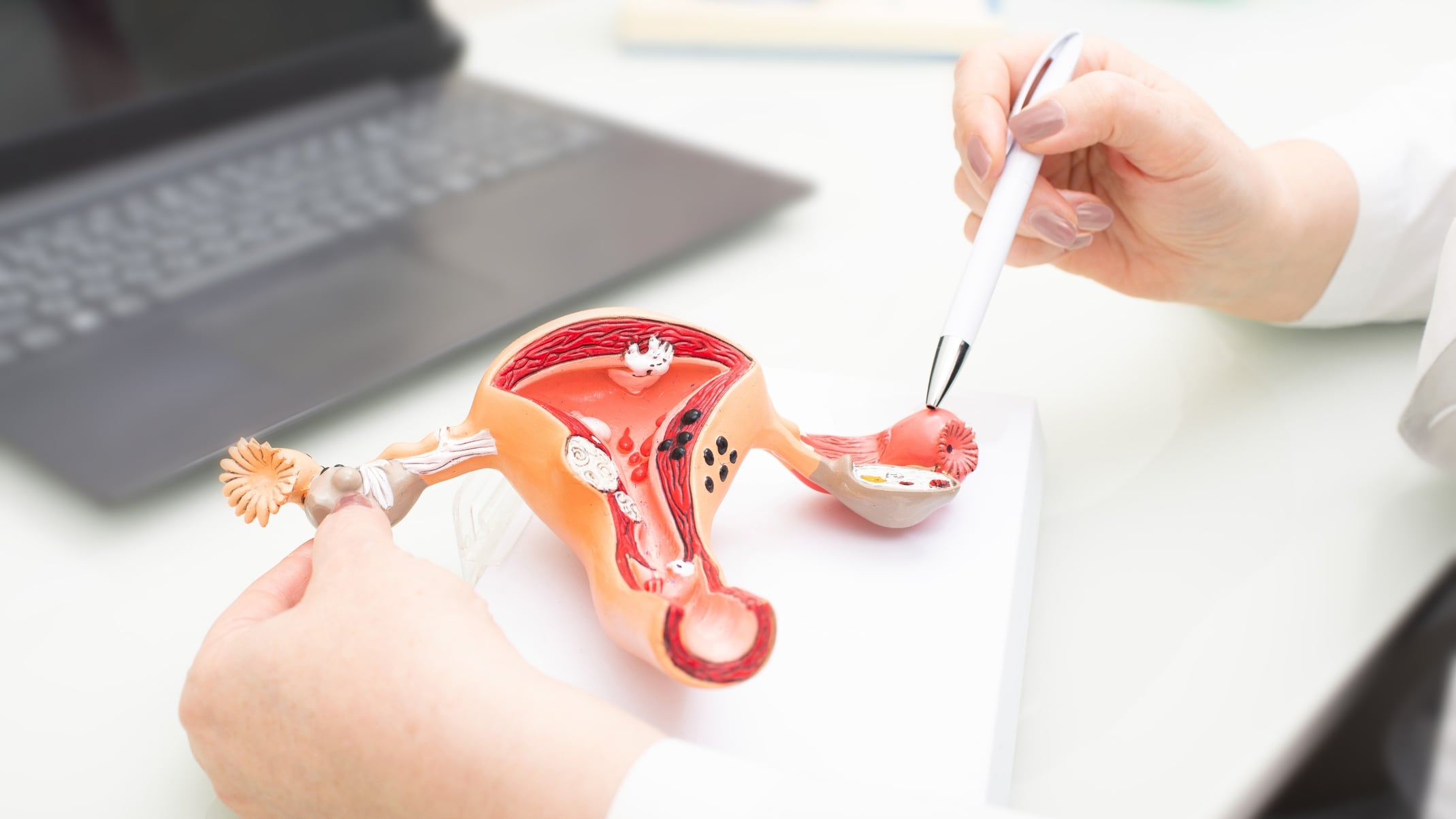Gynecologist showing uterine structure on a uterus model. Uterus model on gynecologist's desk close-up
