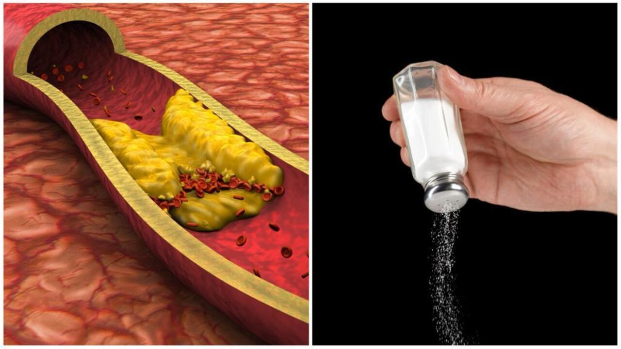 Colesterol y sal. (Imagen de referencia).