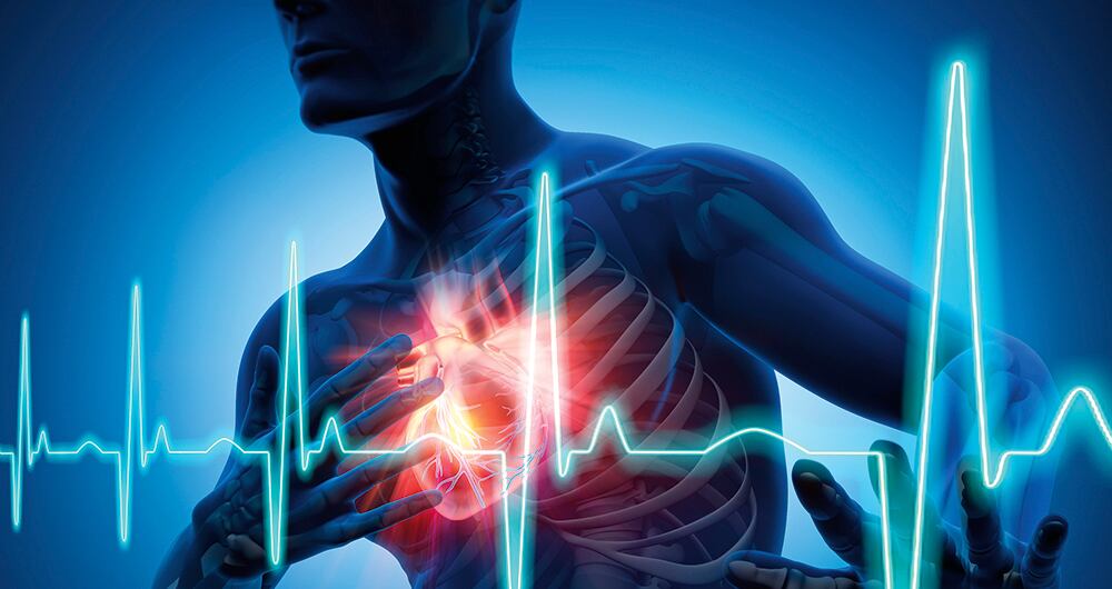 Quienes padecieron Covid tienen más riesgo de sufrir infartos.