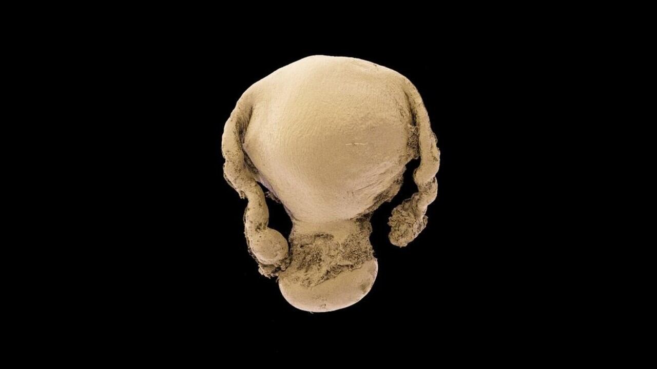 El método HiP-CT produjo imágenes 3D del útero humano que abrieron nuevas vías para comprender los trastornos ginecológicos y la anatomía reproductiva femenina.