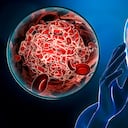 Hombre que sufre un accidente cerebrovascular o un accidente cerebrovascular o un ataque cerebral con coágulo de sangre o ilustración de representación 3D de trombo. Medicina, patología médica, salud, lesiones cerebrales, conceptos científicos.