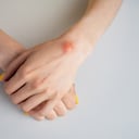 En ocasiones las masas que aparecen en las manos pueden estar relacionadas a otras lesiones.