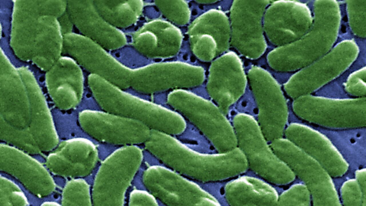 Agrupación de la bacteria Vibrio vulnificus revelada en la imagen microscópica electrónica de barrido (SEM) ampliada 13184x, 2005. Imagen cortesía de los Centros para el Control de Enfermedades