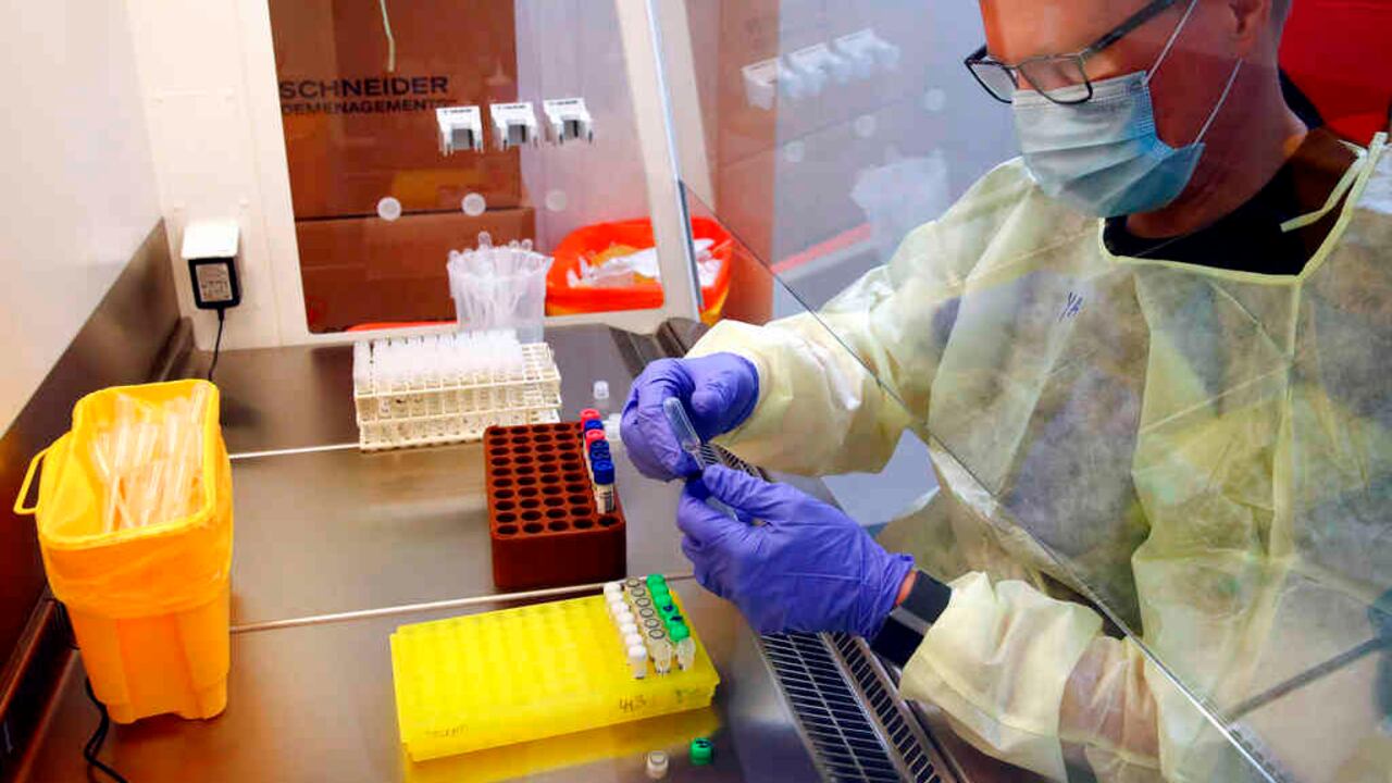 Comprobar con un análisis de sangre el estado del sistema inmunológico de los enfermos de covid-19 a su ingreso en el hospital permitiría estimar su evolución, afirman expertos.