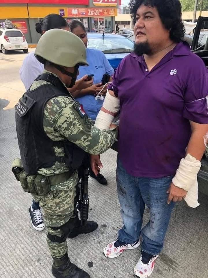 El influencer habría sufrido un atentado meses atrás, recibió varios impactos de bala en sus brazos