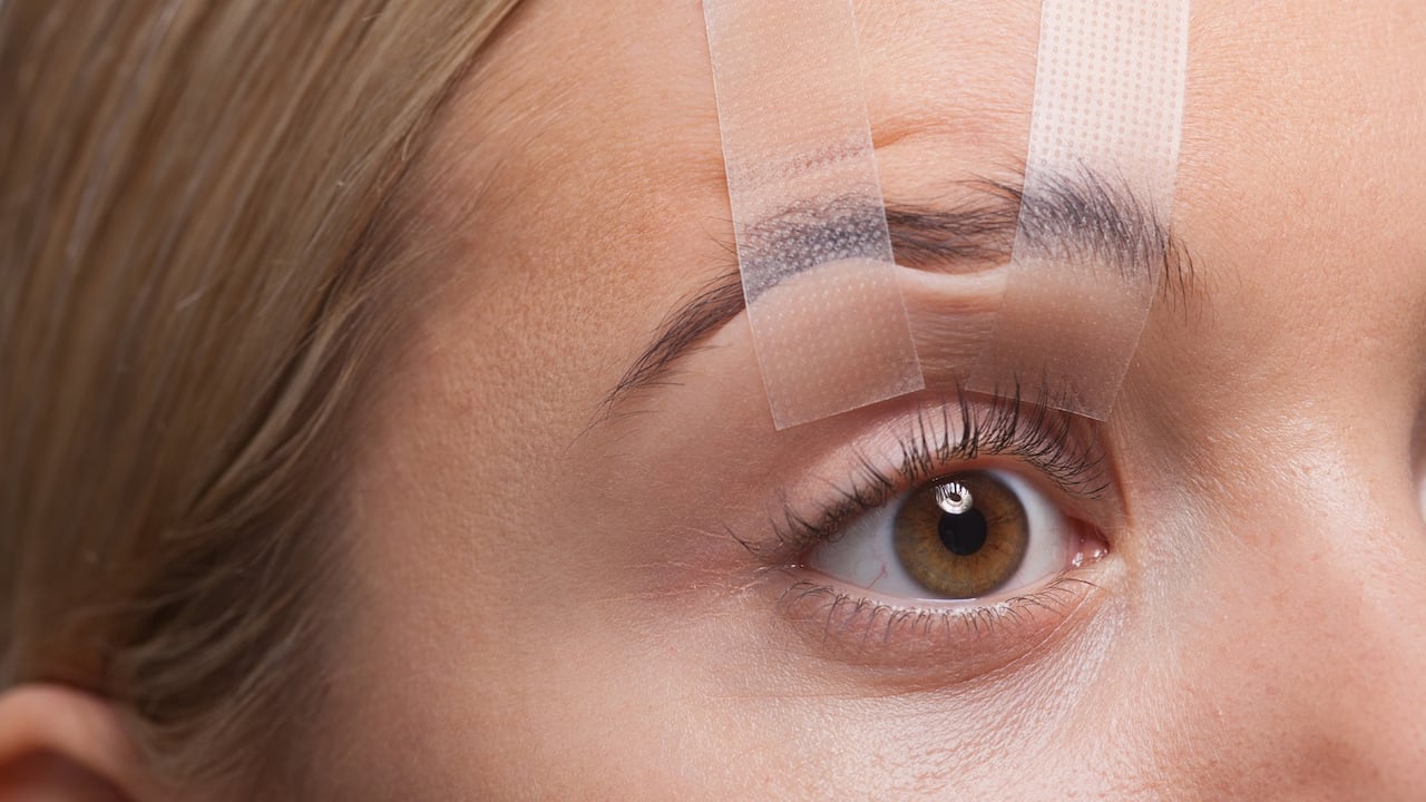 Los párpados caídos pueden registrarse por alguna enfermedad o como consecuencia del envejecimiento.