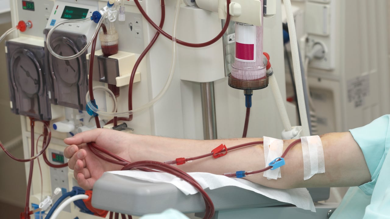 Entre las condiciones más conocidas de enfermedades de alto costo se encuentran la enfermedad renal crónica, diabetes , el VIH / Sida, la hemofilia y otras coagulopatías, la artritis, la hepatitis C y 11 tipos priorizados de cáncer.