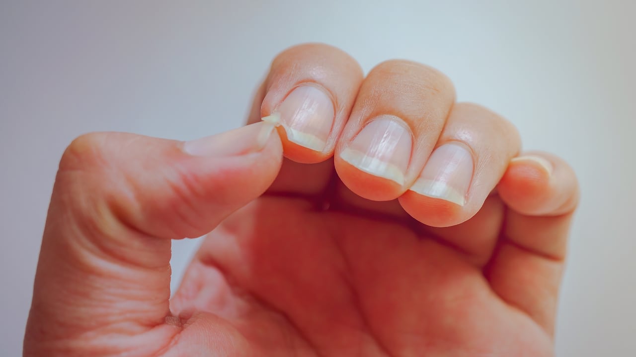 El aloe vera es muy utilizado para evitar las uñas quebradizas