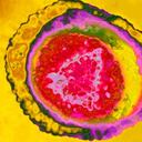 El virus del herpes humano tiene ocho cepas. La 1 causa herpes labial, pero también puede ser encontrada en los genitales; la 2 causa herpes genital, la 3, varicela y herpes zoster; la 4 (o EBV), mononucleosis infecciosa y linfoma de Burkitts; la 5 o citomegalovirus causa el síndrome de la mononucleosis; la 6 y la 7, roséola y la 8 causa sarcoma de Karposis y linfoma.
