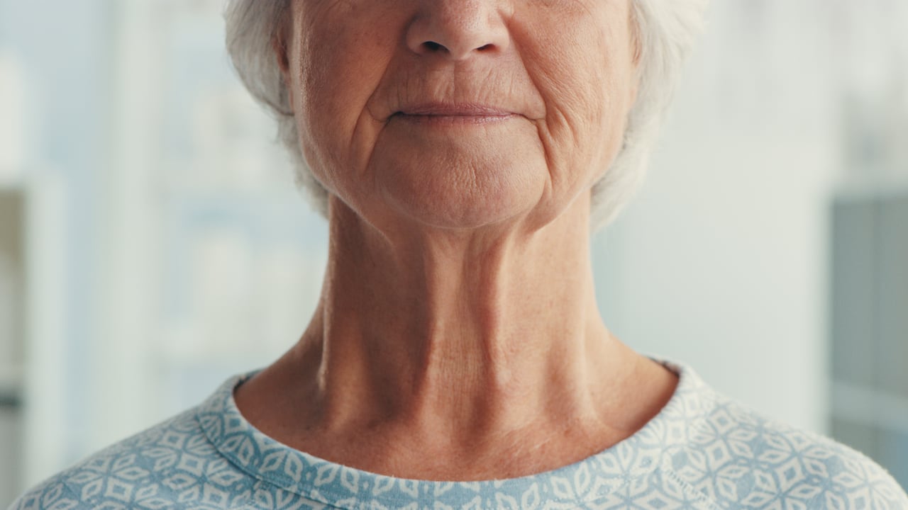 Las arrugas en el cuello pueden darse por diversos factores como fumar tabaco, una mala alimentación, entre otros.