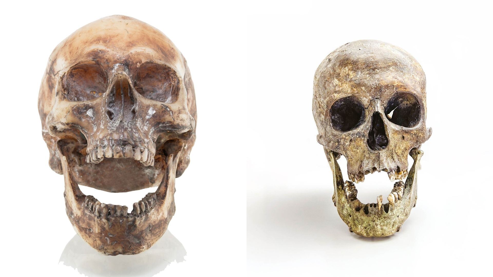 Los conquistadores españoles observaron que muchas personas en los Andes tenían cráneos alargados y puntiagudos.