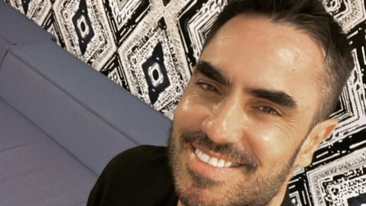 El actor mostró una situación que ocurrió en su rostro.