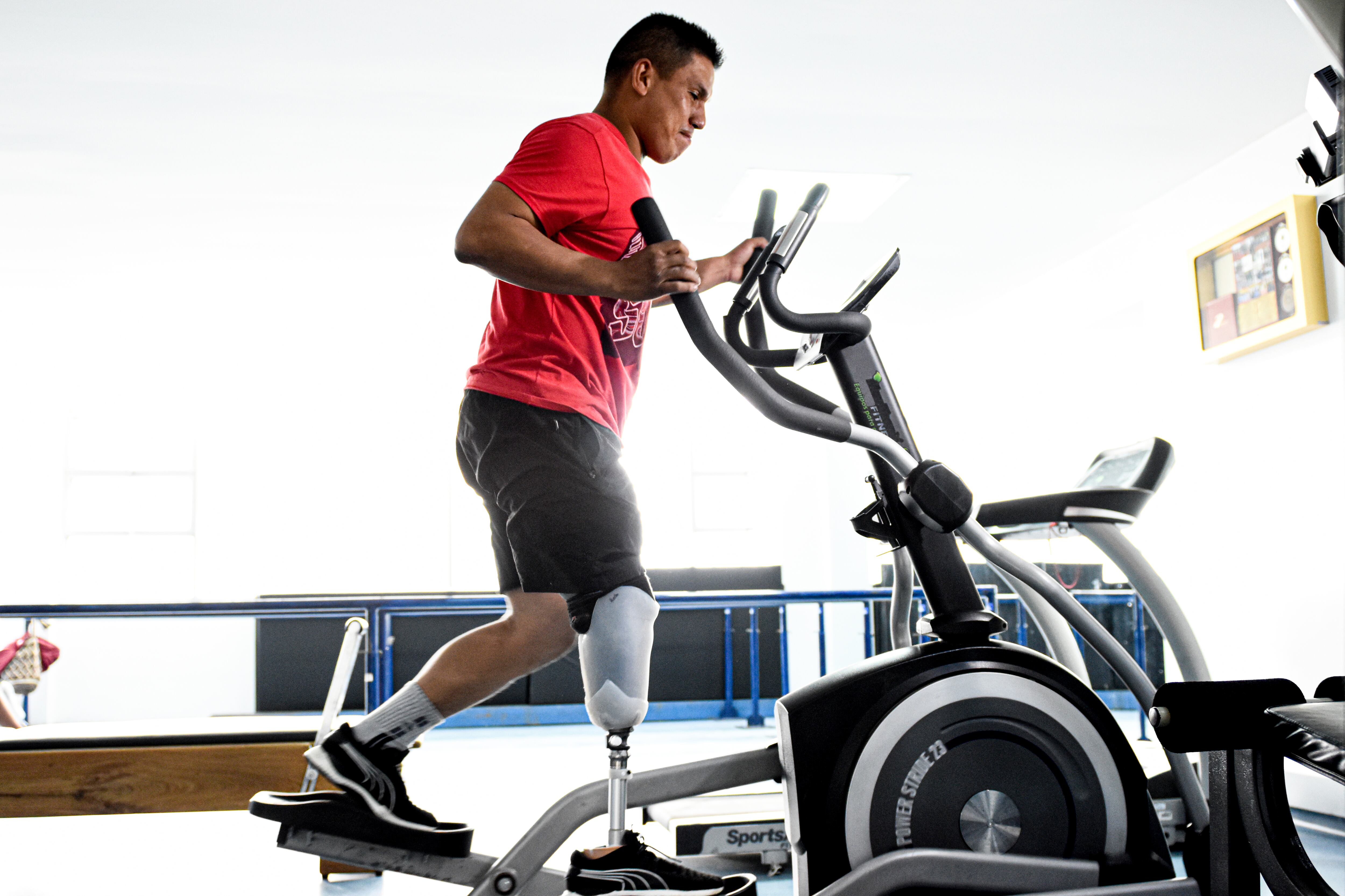 Elaboración de Protesis minas antipersona