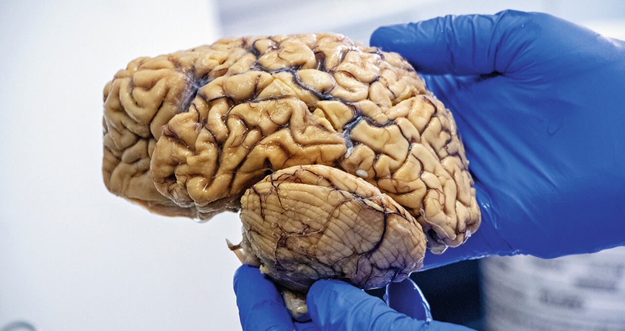 El doctor Francisco Lopera, director del Grupo de Neurociencias de la Facultad de Medicina de la Universidad de Antioquia.