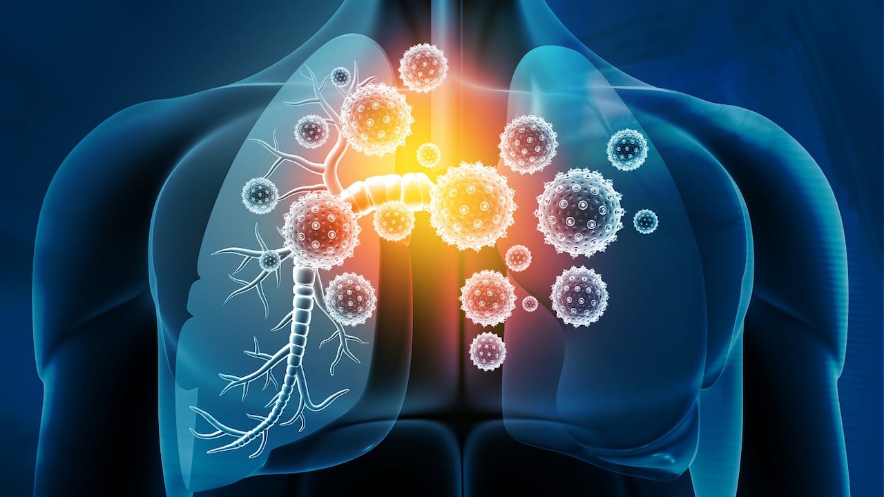 Un material presente en las paredes de la cocina puede generar complicaciones graves.