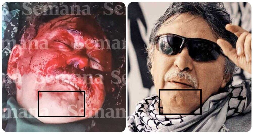 La cicatriz en la barbilla de Jesús Santrich