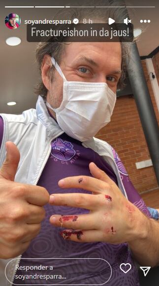 Andrés Parra mostró a detalle algunas de sus heridas.