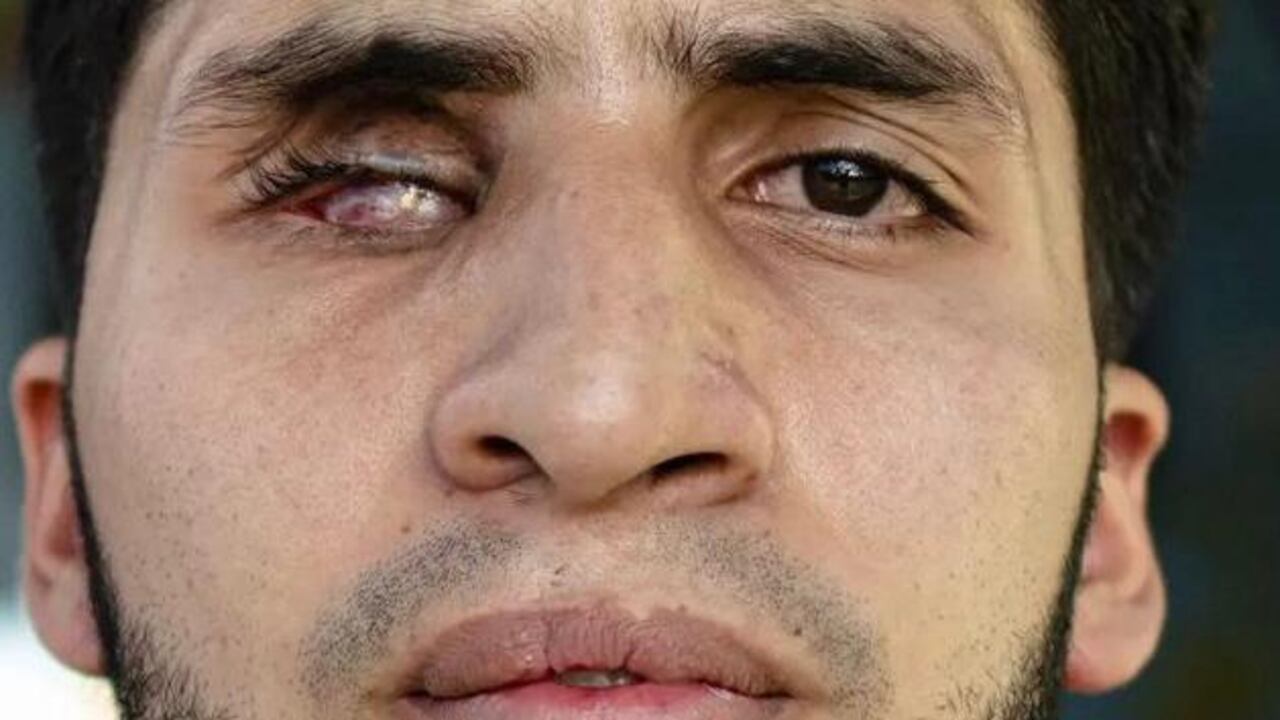 Maicol Cano tiene 22 años y participó en las protestas del 2021.