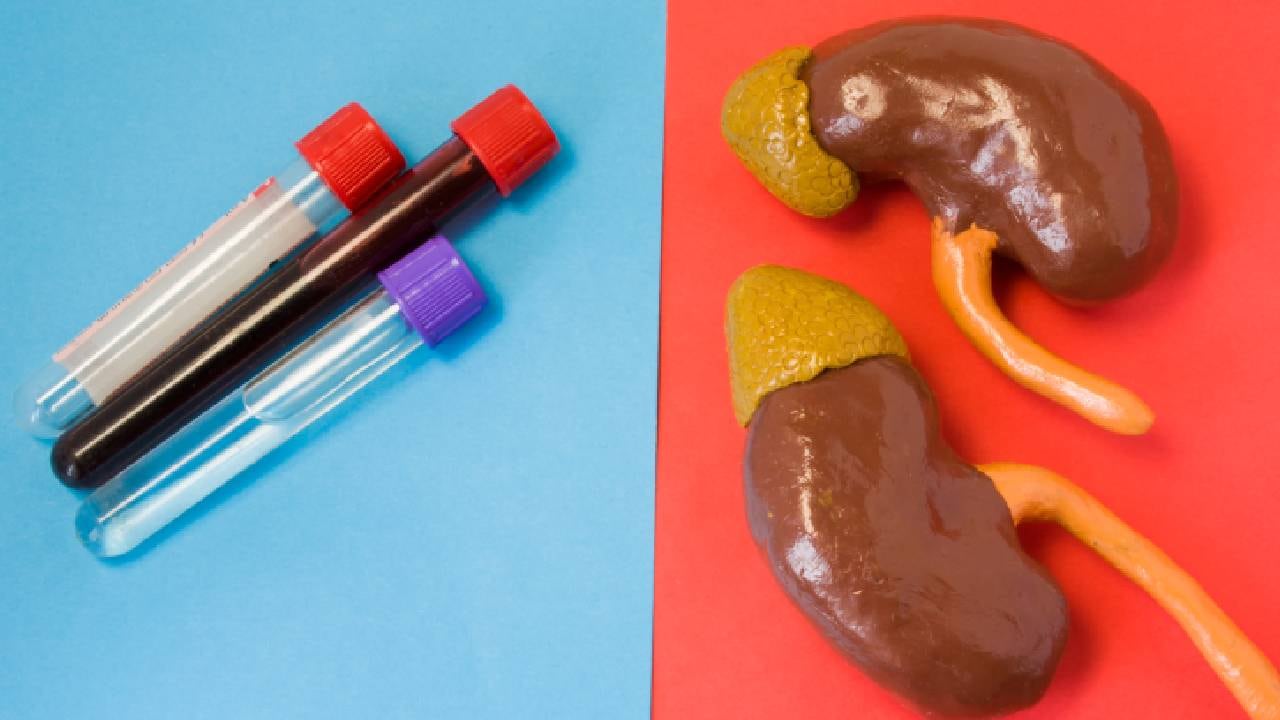 Expertos indican que los cálculos renales se pueden tratar con analgésicos y fluidoterapia. Foto: Getty images.