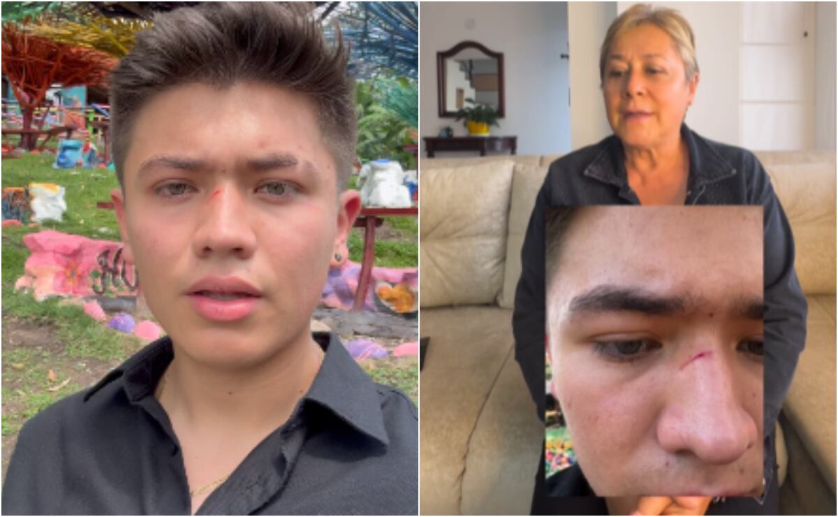 Jim Velásquez fue duramente agredido físicamente por un 'seguidor' y Alina Lozano afirmó que todo fue su culpa.