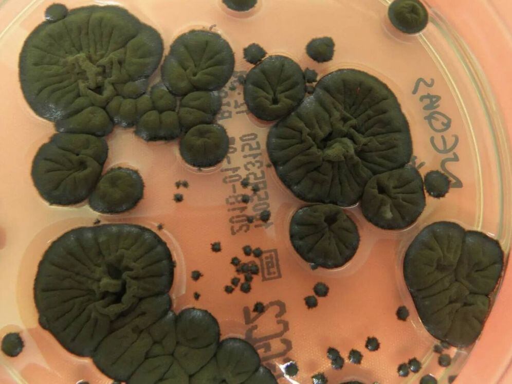 El hongo negro crece más bajo radiación, mostrando un aumento cercano al 10%.