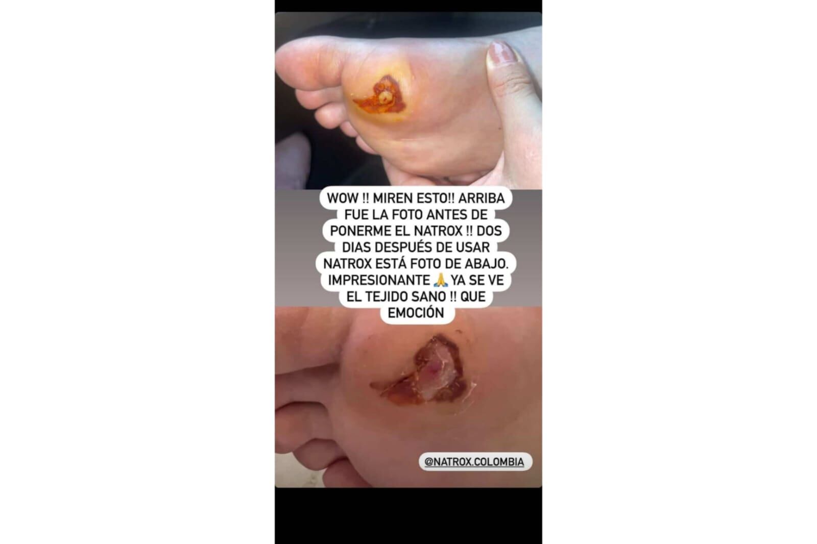 Estado de salud Daniella Álvarez