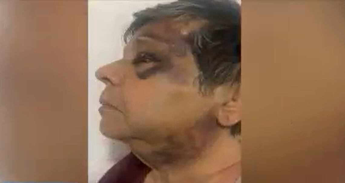 Una mujer de la tercera edad fue brutalmente atacada en el sur de Florida por un hombre que la golpeó en la cabeza con un sartén mientras caminaba por la calle