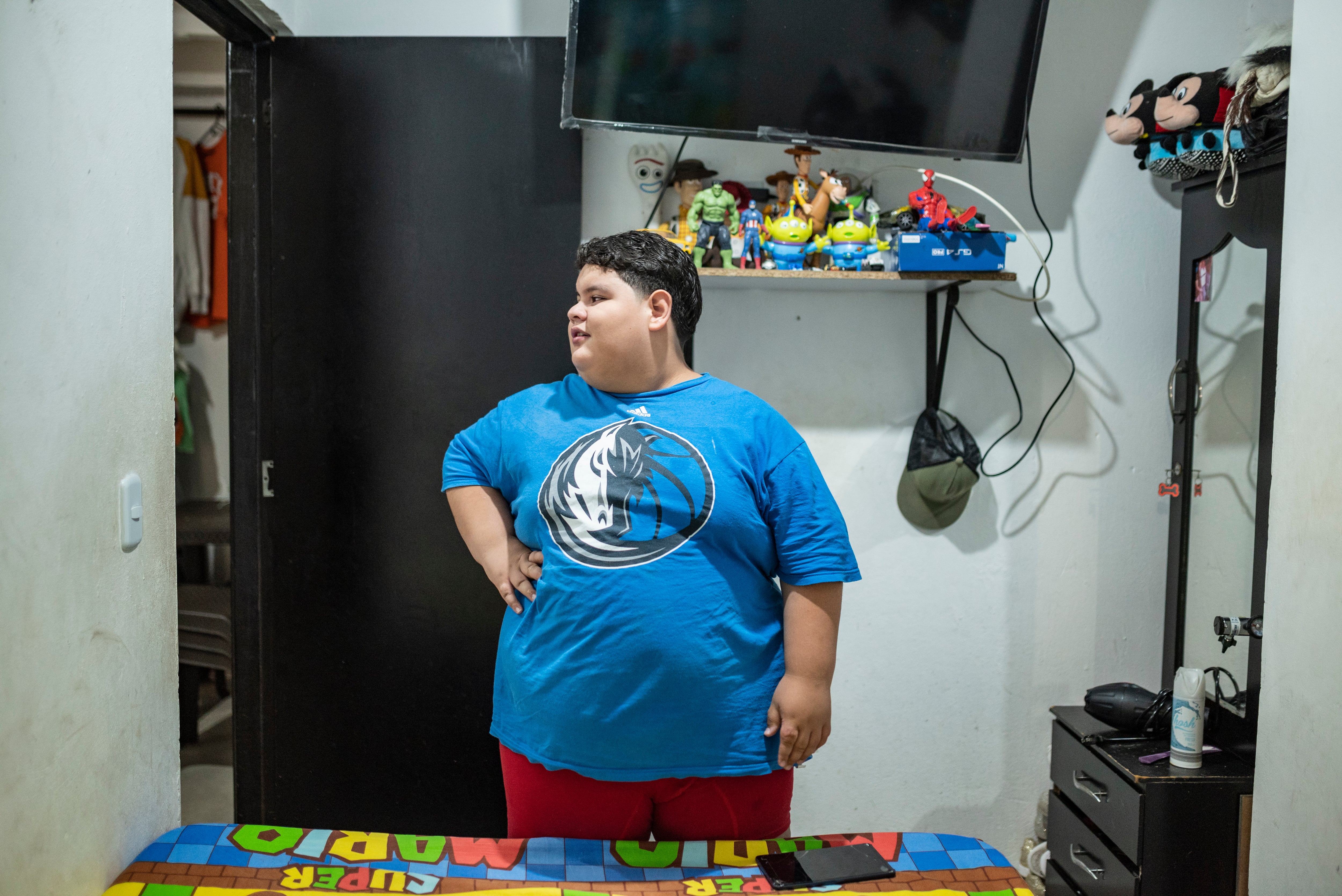 Niño Alejandro Pineda Vásquez Caso de Obesidad Infantil