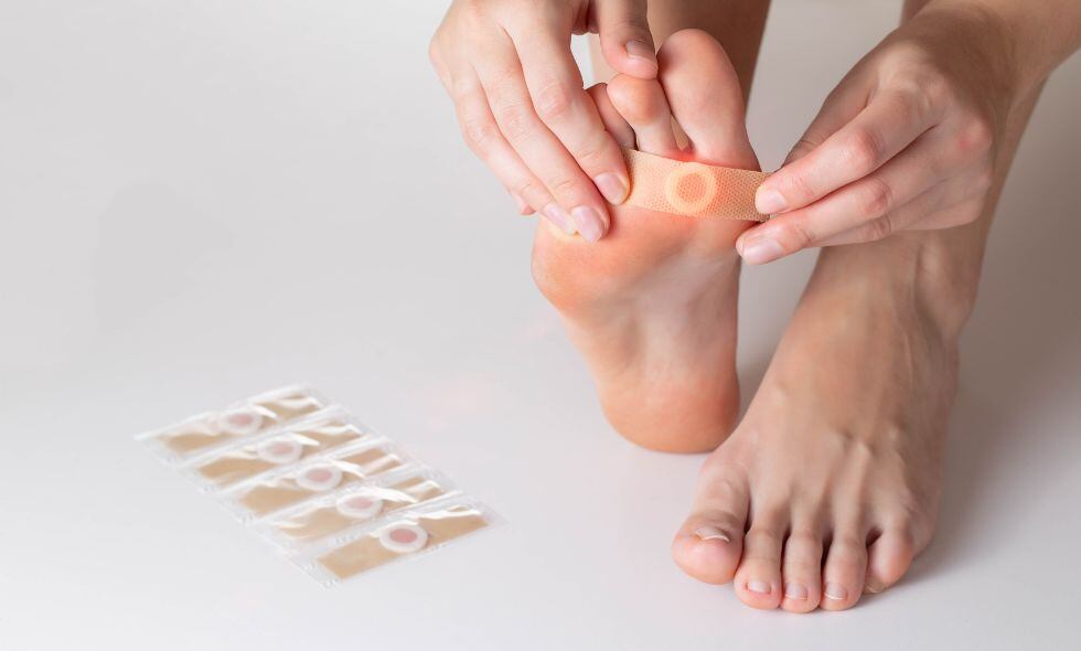 Ojo de pescado - verruga plantar