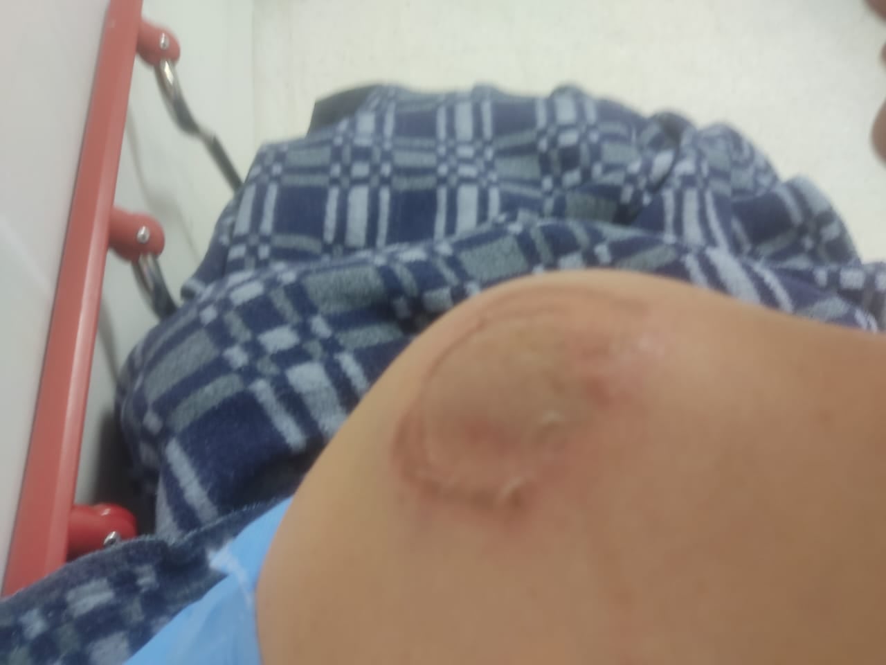 A la cárcel el hombre que, en Bogotá, atacó a mordiscos a su esposa y la dejó encerrada