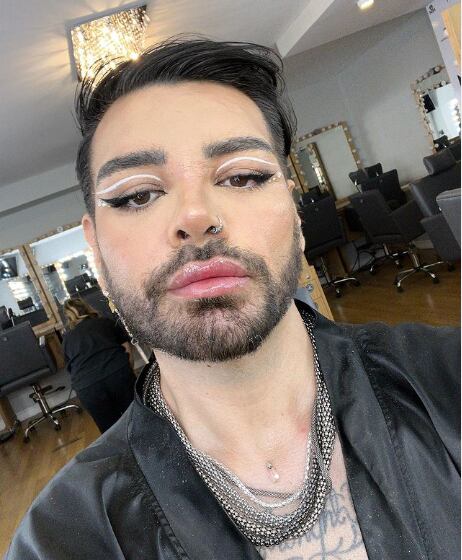 Fran Mariano se hizo 40 cirugías para parecerse a Ricky Martin