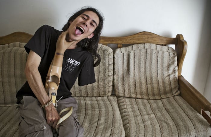 BENJAMIN: El 14 de agosto del 2008, Benjamín Morales y su grupo de amigos disfrutaban de las tradicionales ‘fiestas de la Ituanguinidad’, en Ituango, Antioquia. “Era jueves y se celebraba el día de la juventud”, recuerda. A las 10:30 p. m., mientras caminaban por una calle peatonal, un paquete con explosivos que miembros Frente 18 de las FARC habían abandonado en el interior de una caneca de basura hizo explosión. Ocho personas murieron y 79 más resultaron heridas. Del grupo de amigos, Benjamín fue el más afectado. Lo trasladaron a Medellín y tras ocho horas de cirugía tuvieron que amputarle el brazo izquierdo. Semanas más tarde la familia, cansada de tanta violencia, decidió radicarse en Medellín para empezar una nueva vida. Benjamín terminó el bachillerato y desde que recibió el grado no se corta el pelo. Le gusta dibujar, el punk y el rock clásico. Hoy, a los 21 años, espera continuar con su rehabilitación e ingresar a la universidad para estudiar historia o antropología.