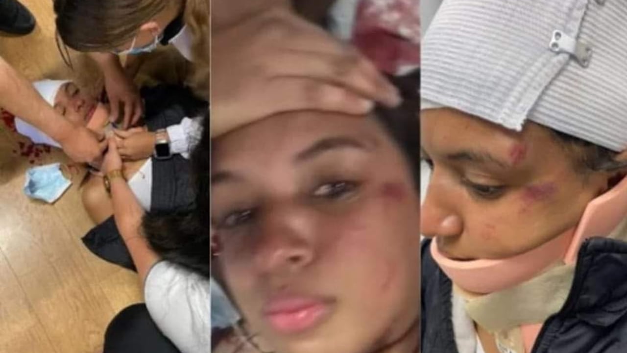 La agresión se presentó en un gimnasio del barrio Chapinero en Bogotá. La mujer resultó herida con un iphone 13. por parte de un hombre de la comunidad LGTBI.